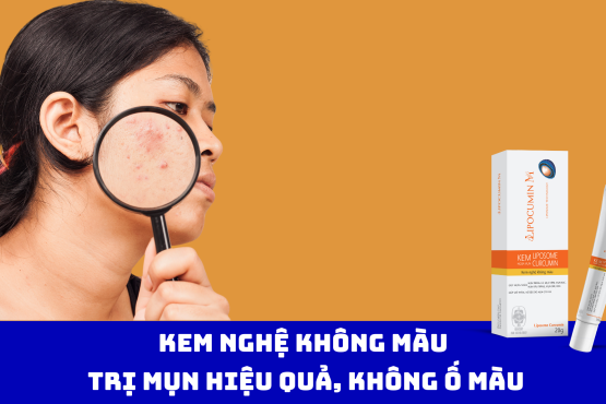 Kem Nghệ Không Màu: Trị Mụn Hiệu Quả, Không Ố Màu